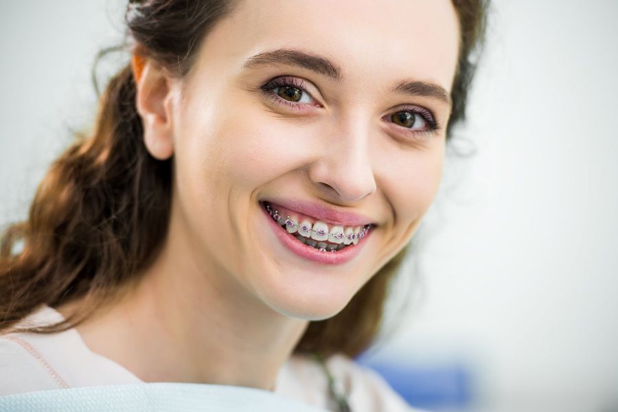 Read more about the article Ai nevoie de aparat dentar ortodontic? Tipuri, costuri și necesități