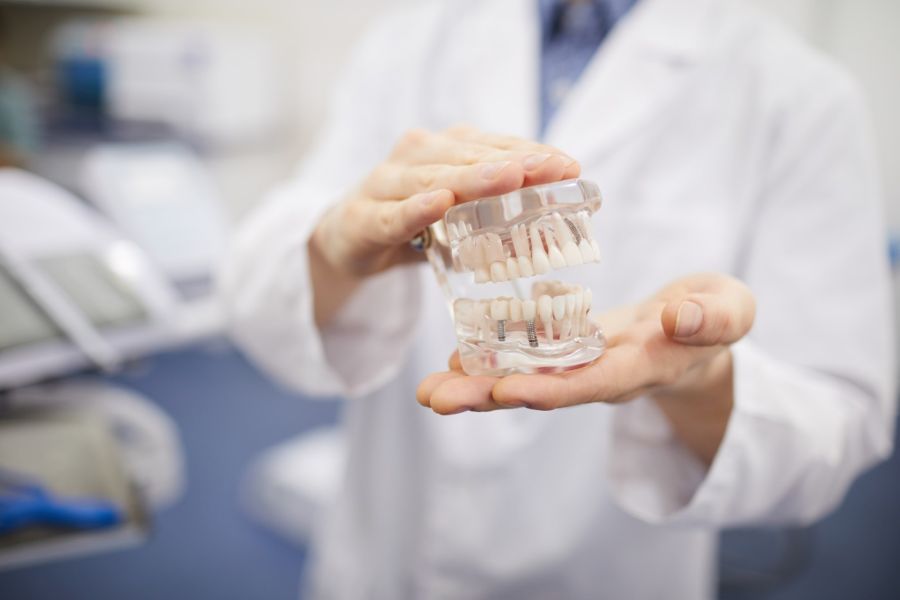 implant dentar Corbeanca