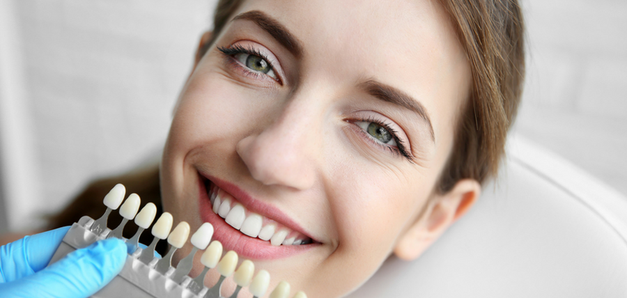 Read more about the article Zâmbet impecabil și natural cu fațete dentare. Beneficii, etape și sfaturi de îngrijire